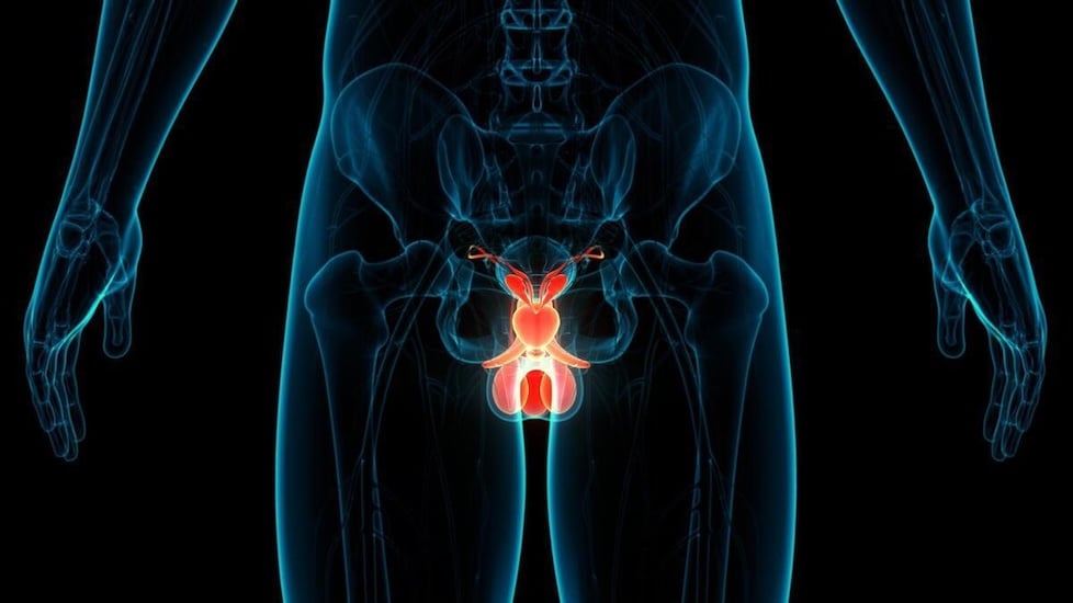 Infecciones Prostáticas médico urólogo